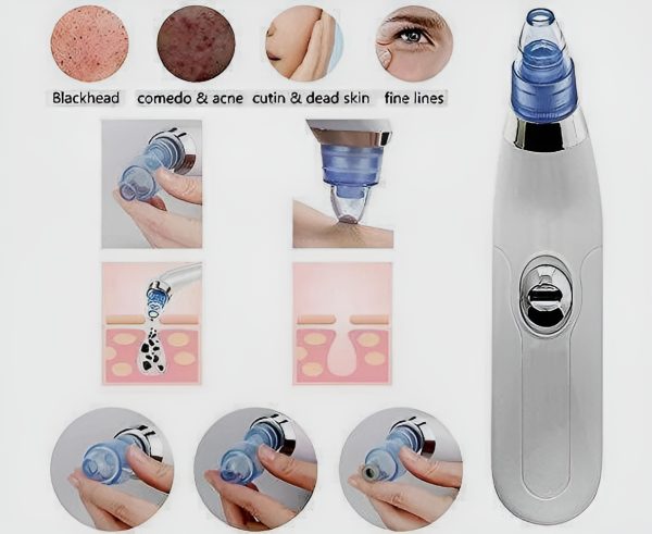 Derma Suction Blackhead Remover (cell Operated )